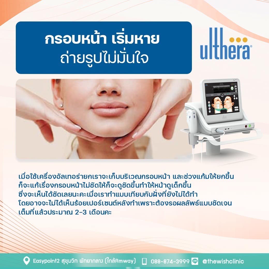 Ulthera