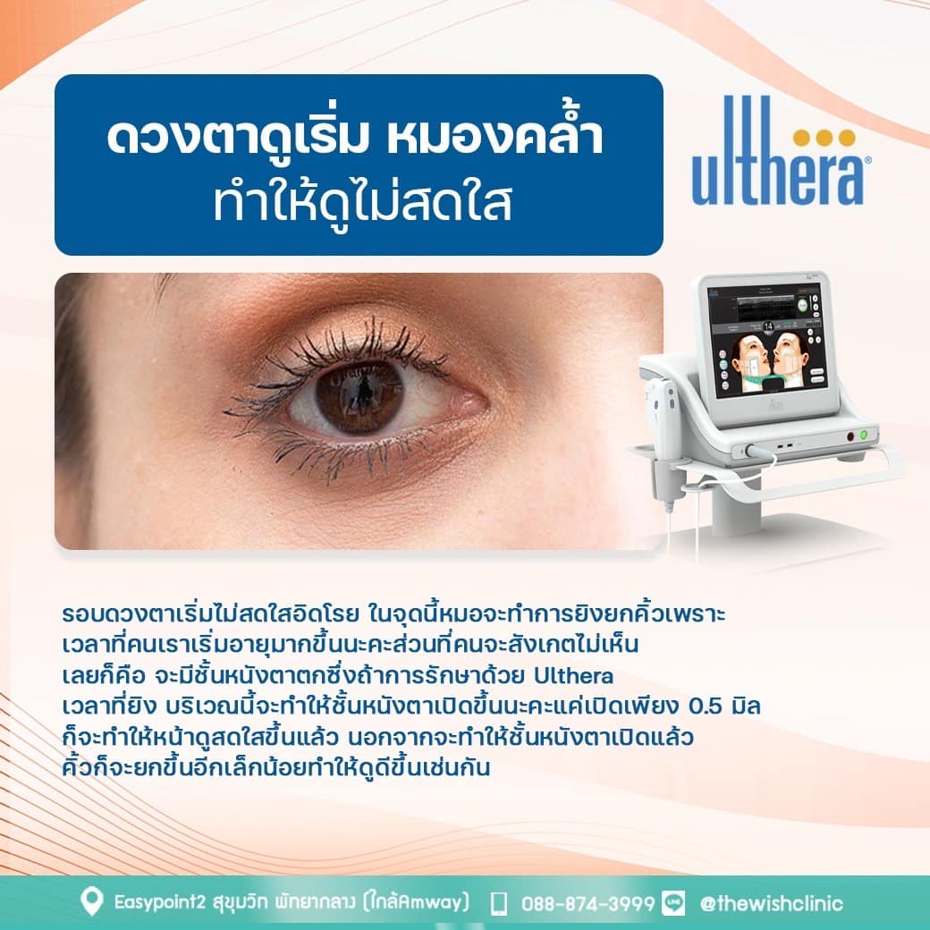 Ulthera