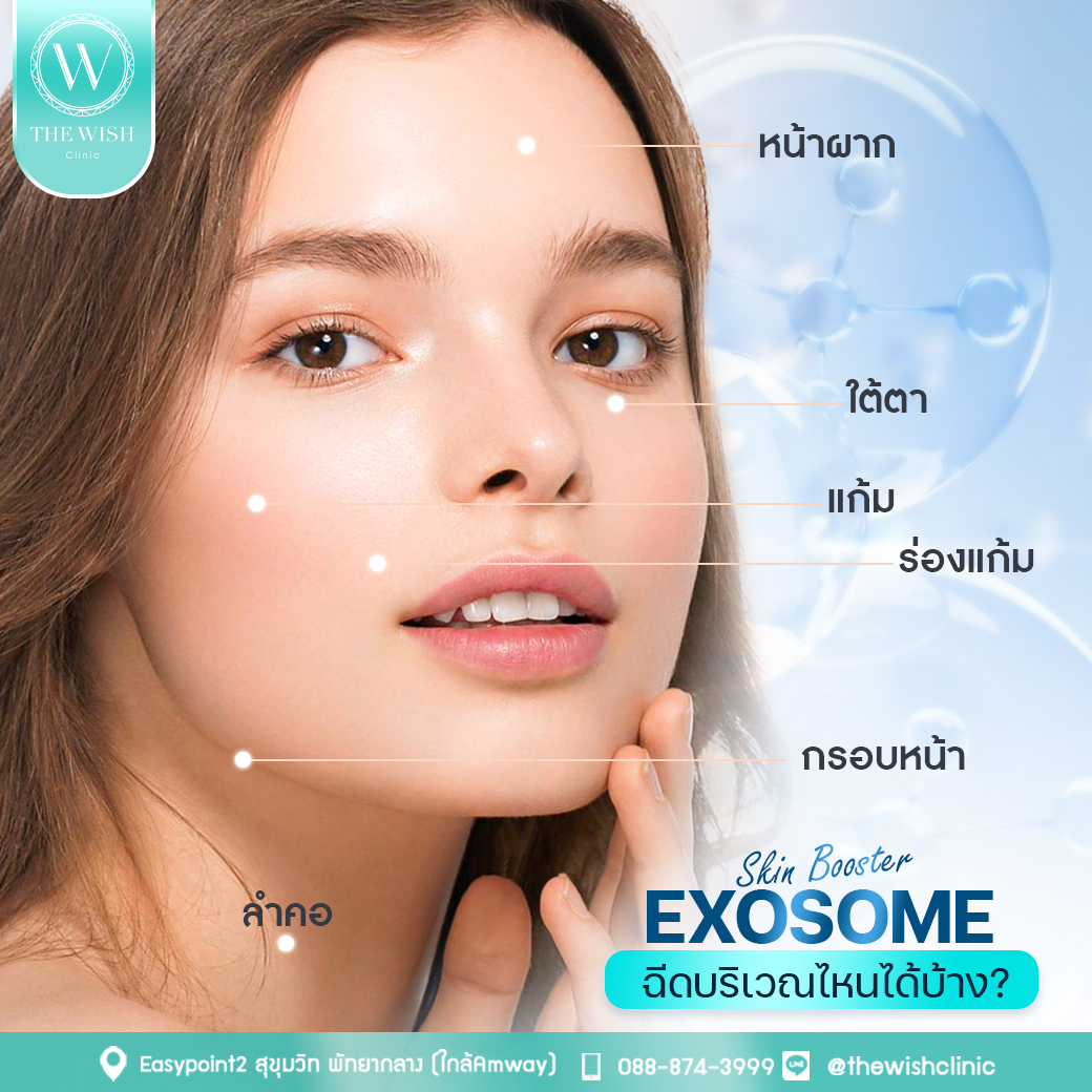 exosome