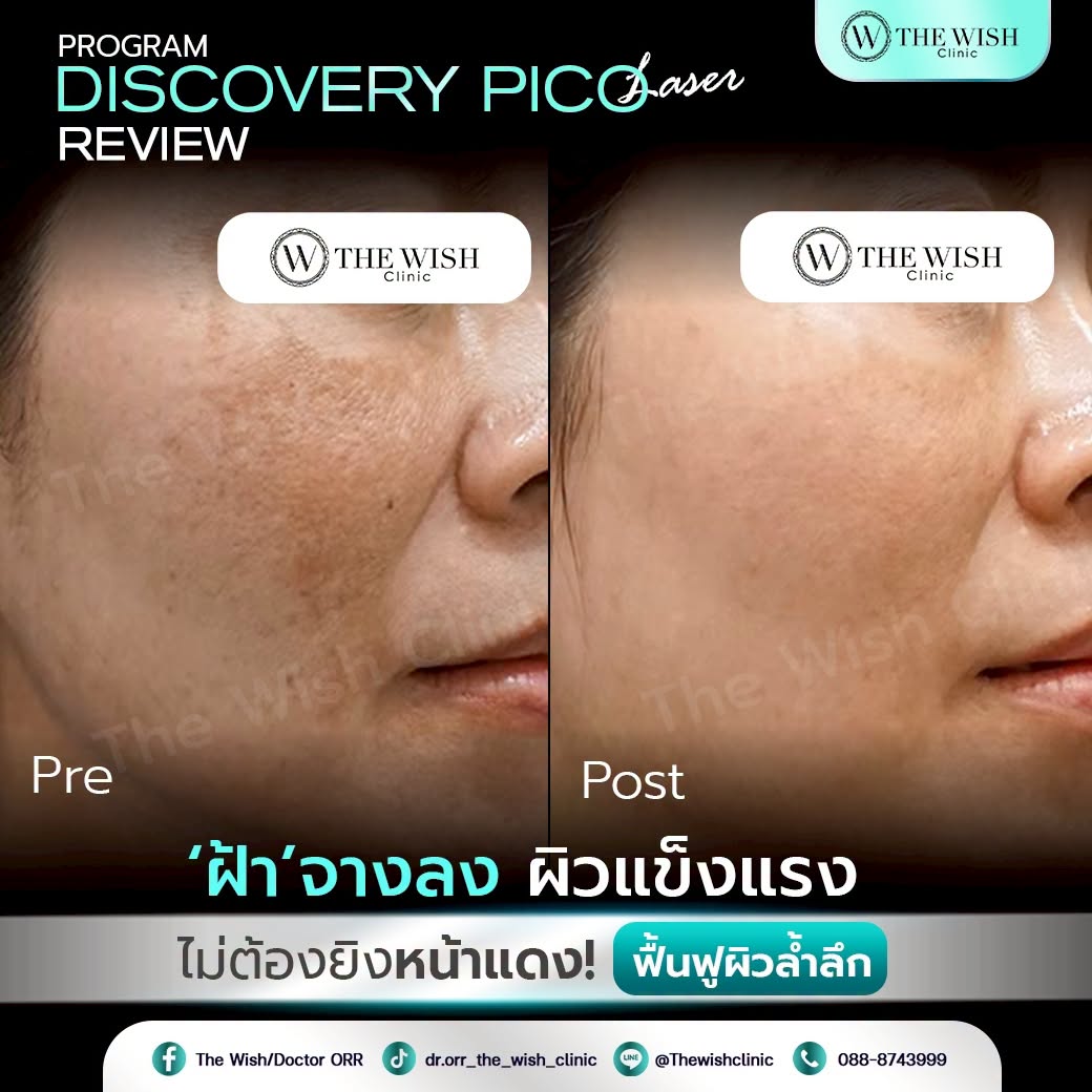 discovery pico