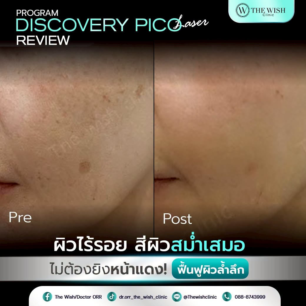 discovery pico