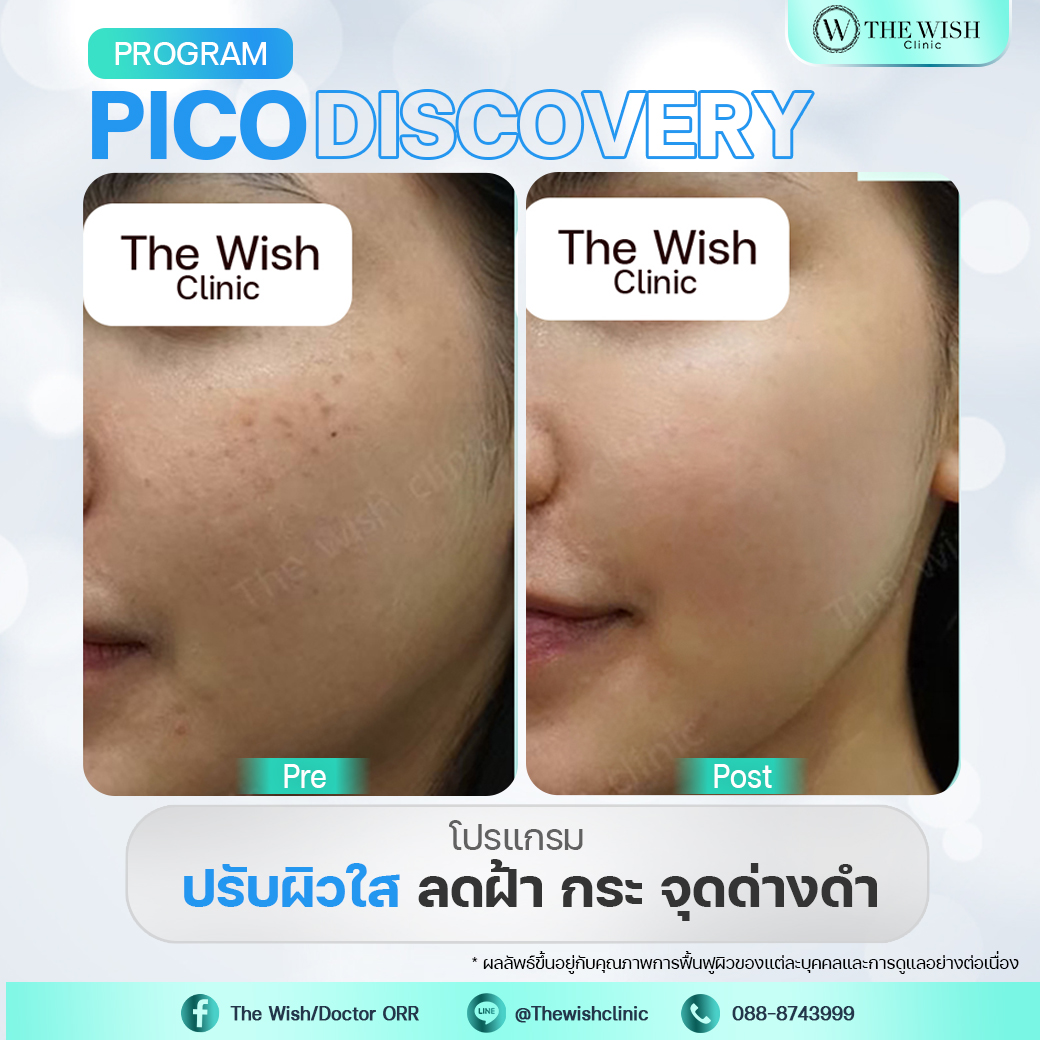pico discovery