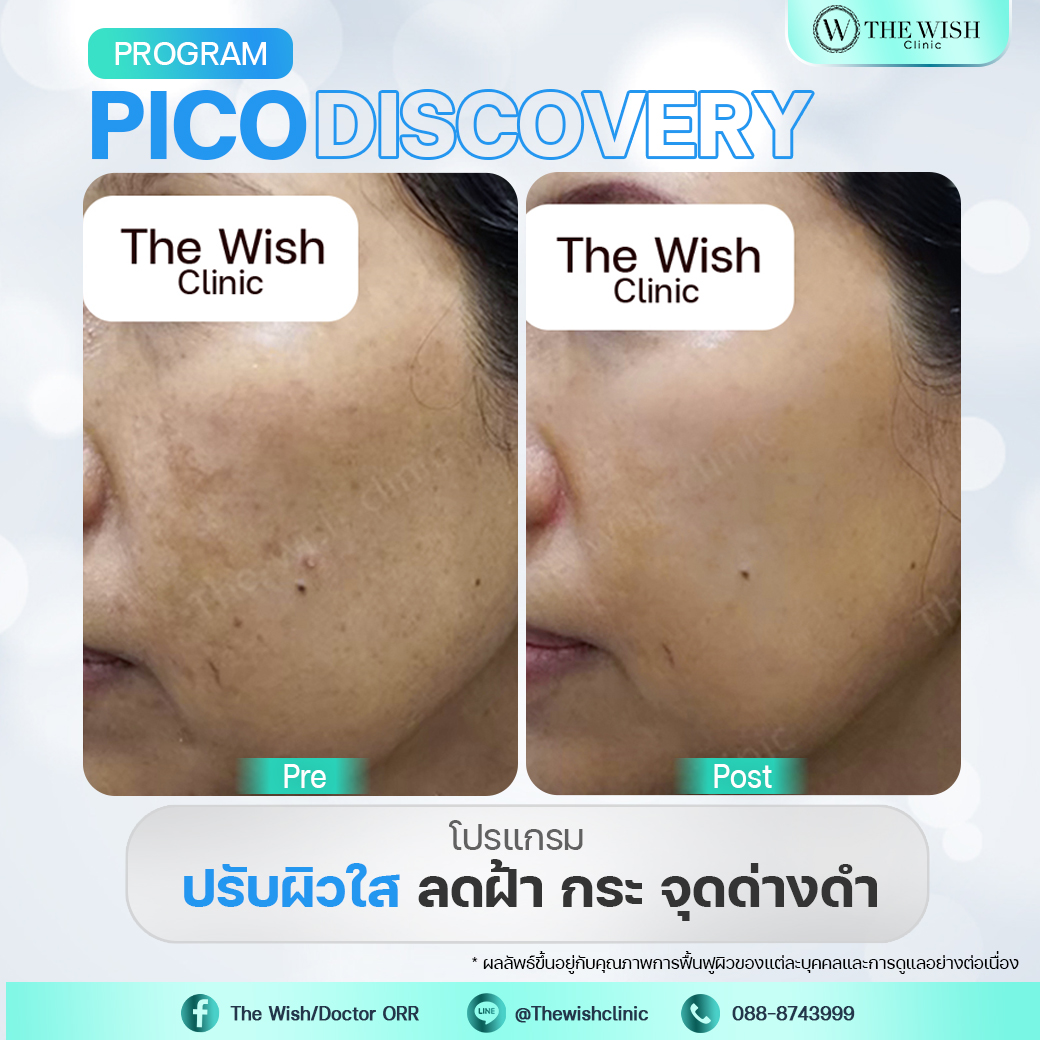 pico discovery