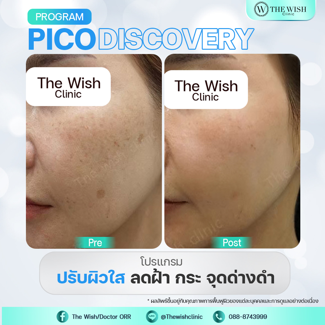 pico discovery