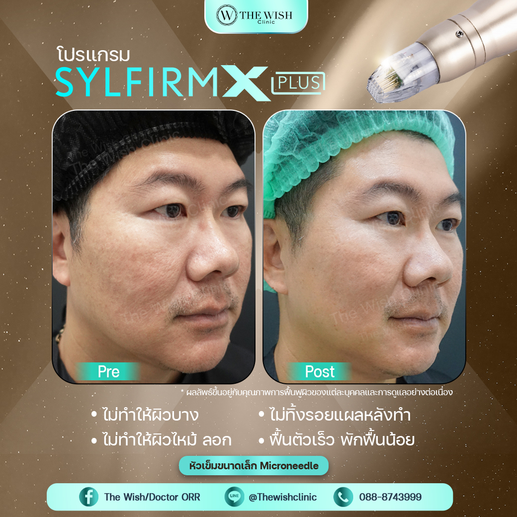 sylfirm