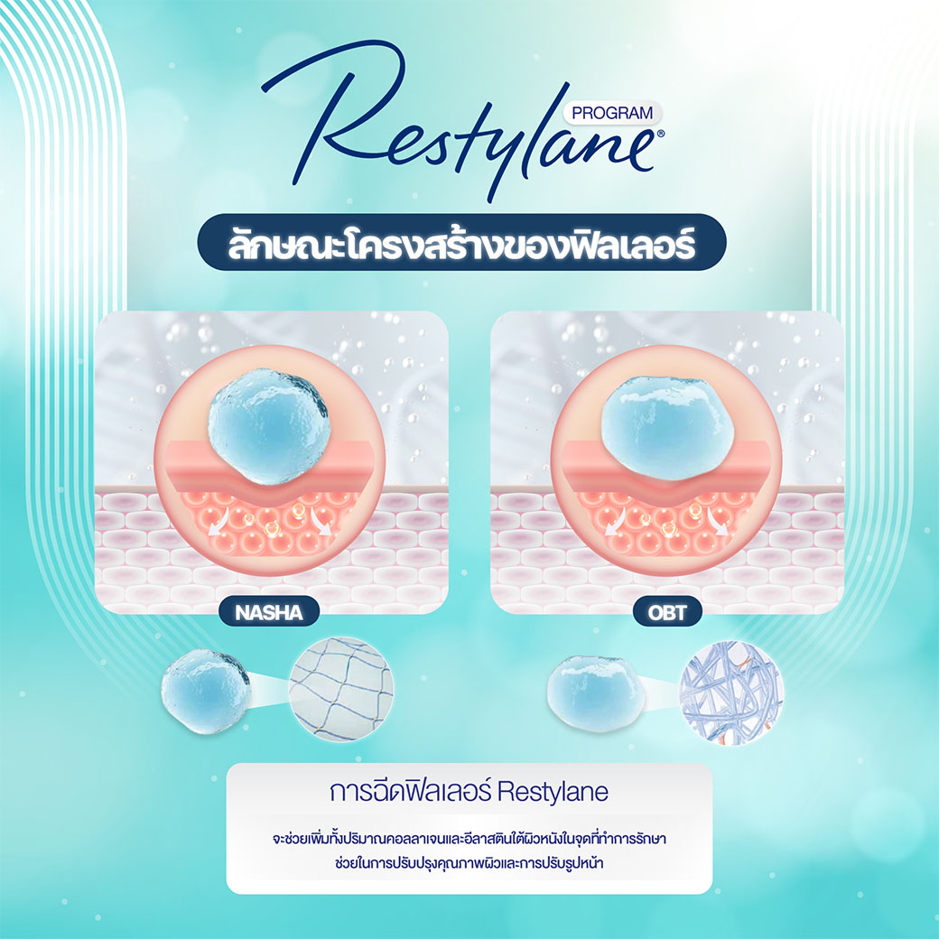 restylane
