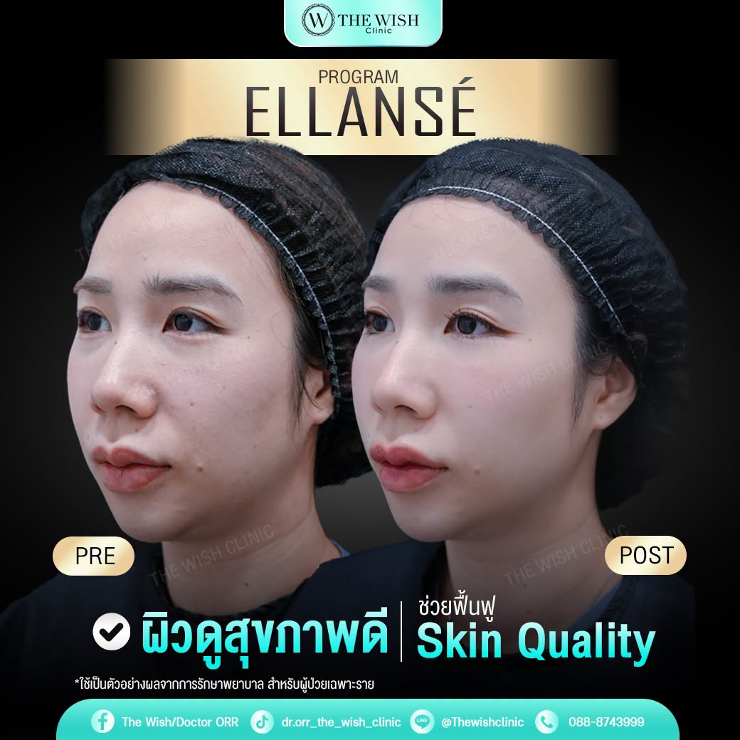 ELLANSÉ