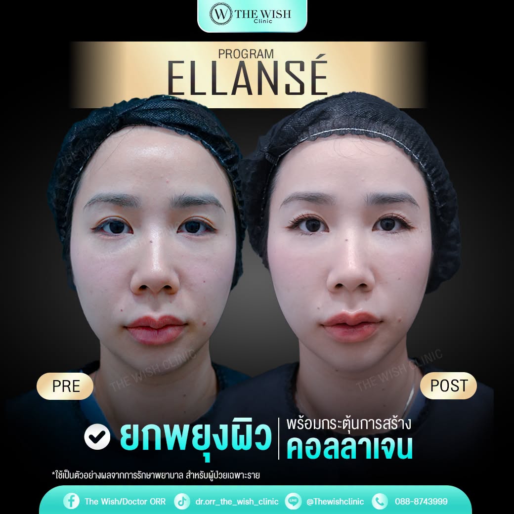 ELLANSÉ