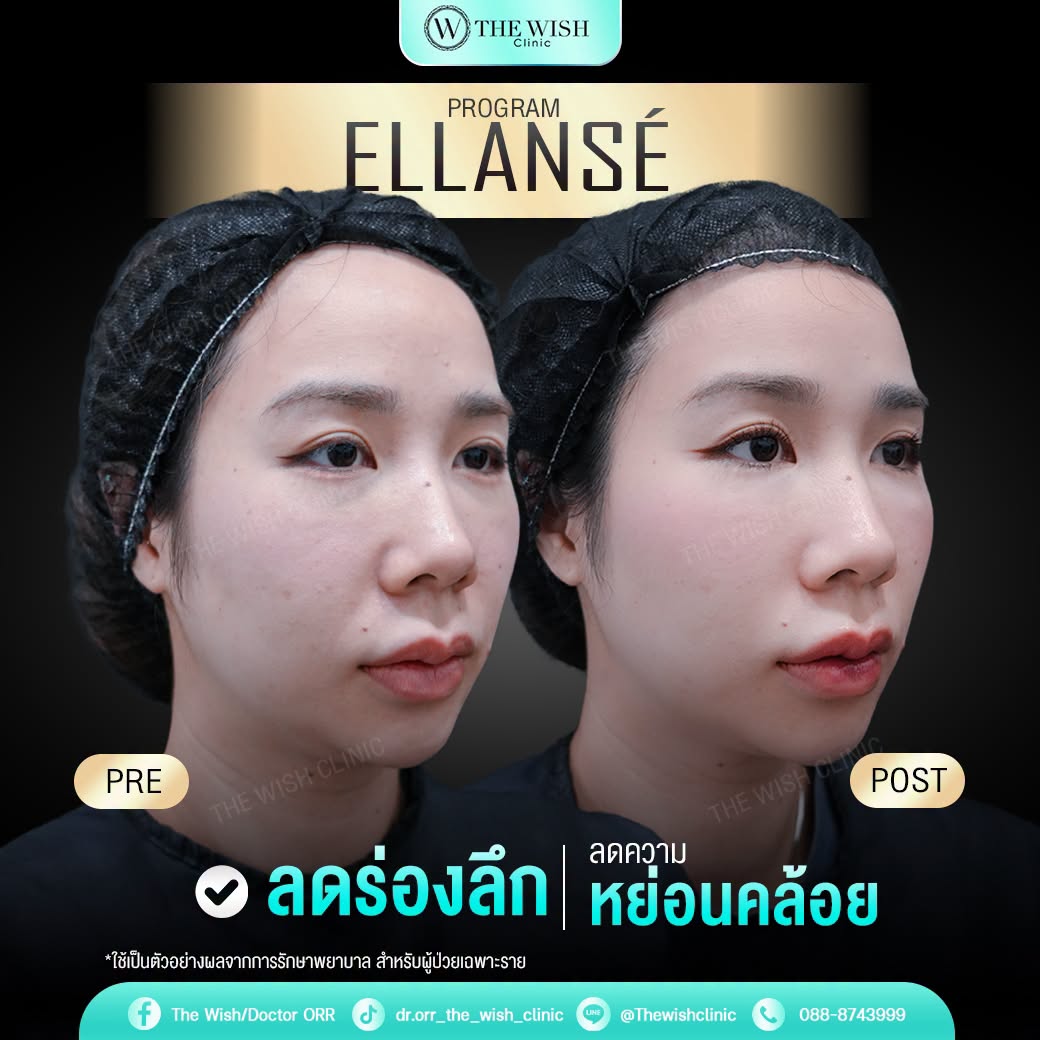 ELLANSÉ