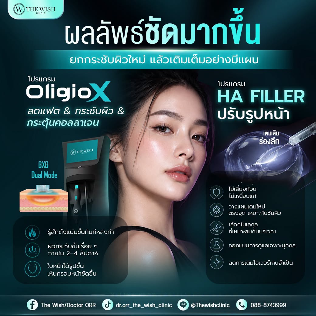 oligo x