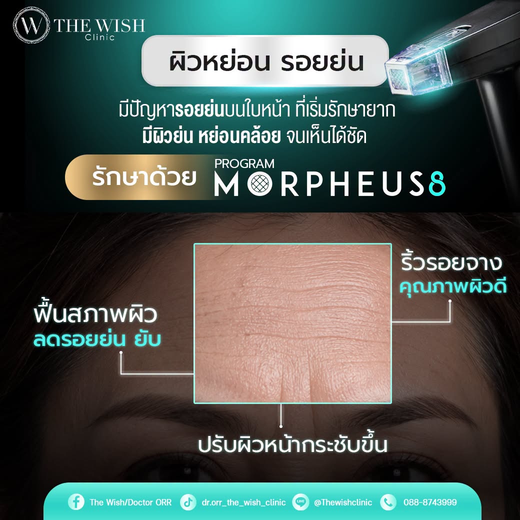 morpheus8