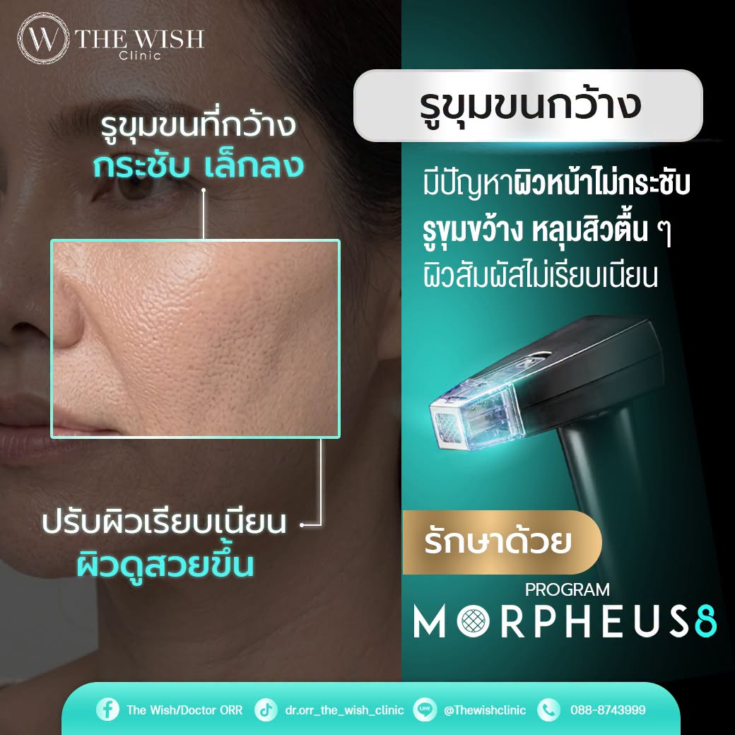 morpheus8