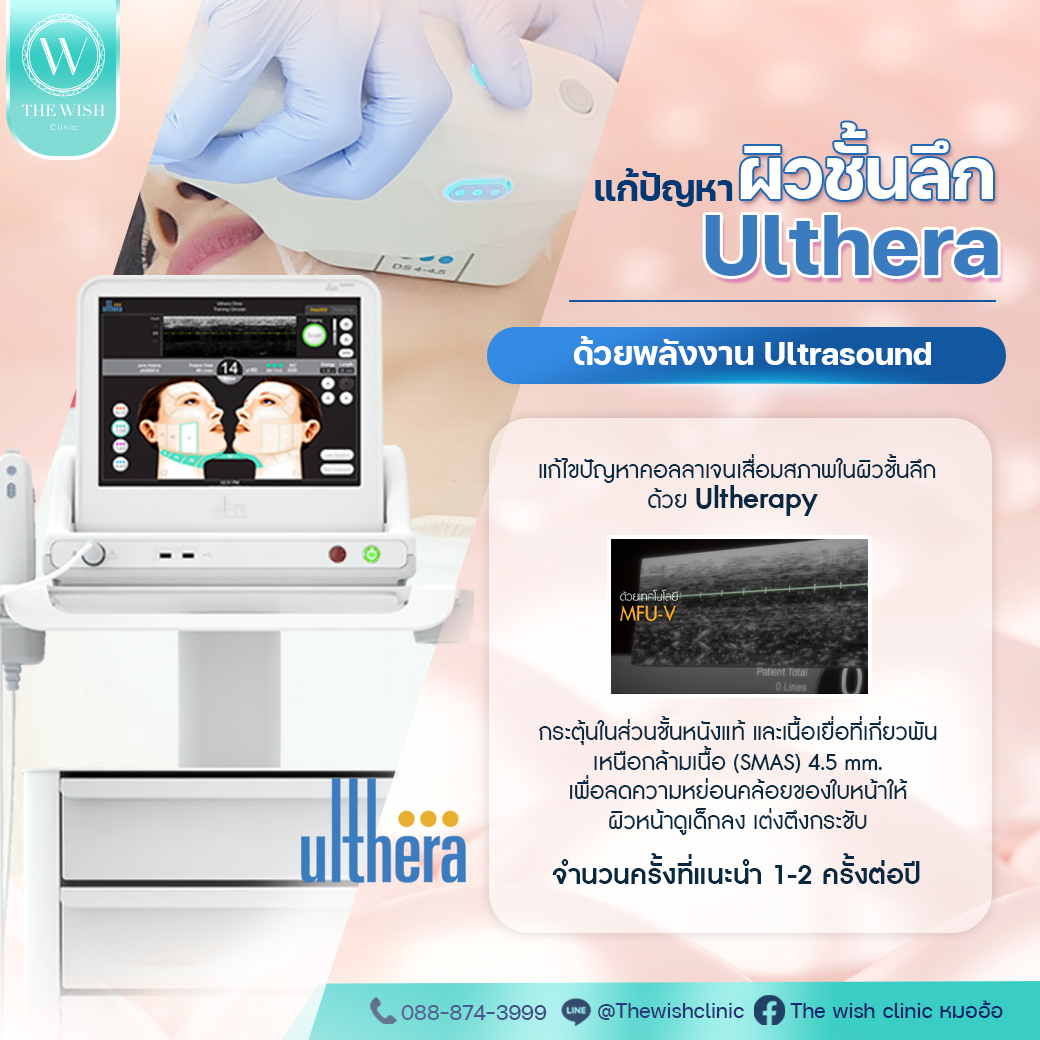 ulthera