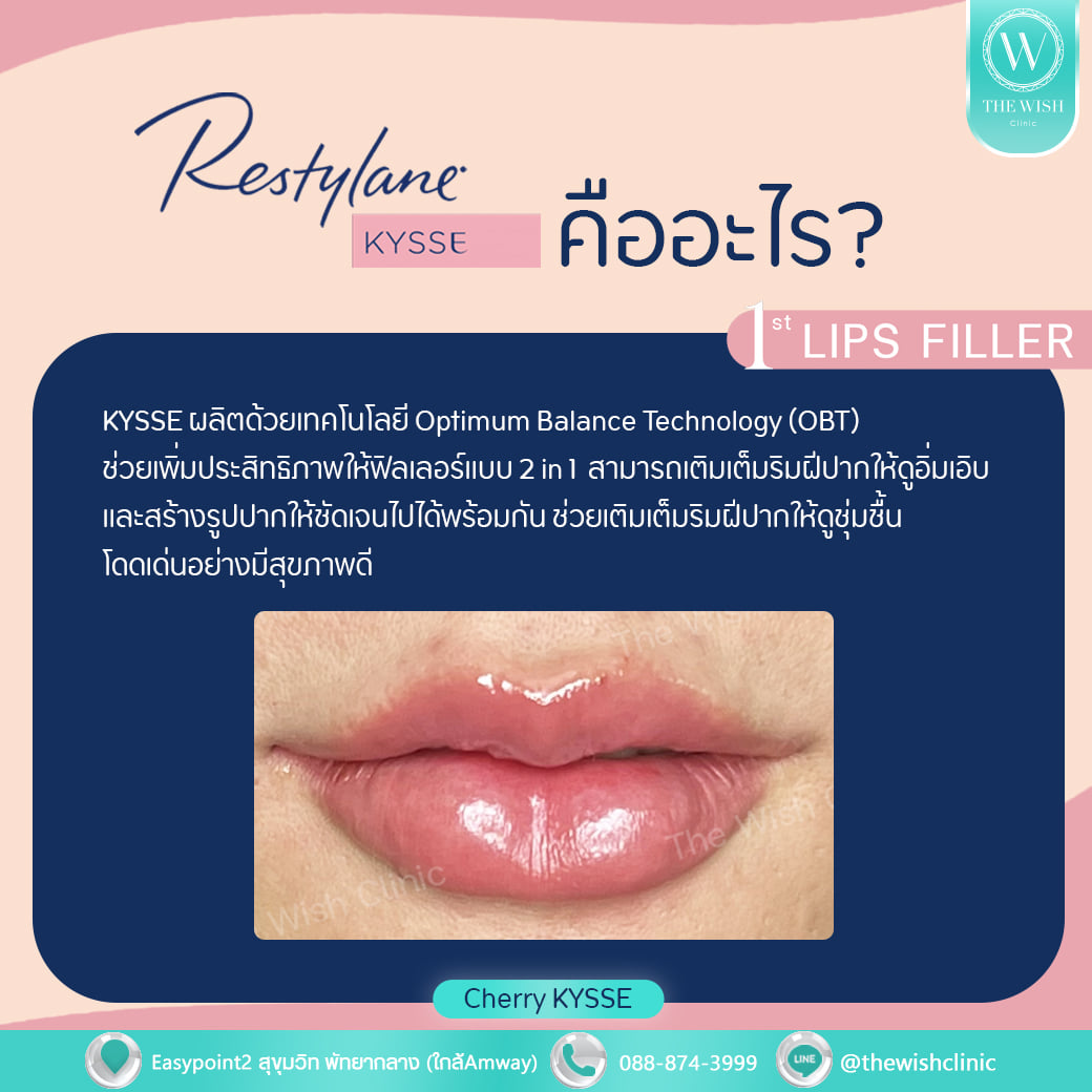 restylane