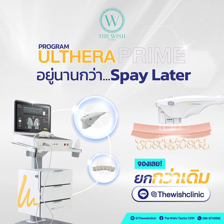 ulthera