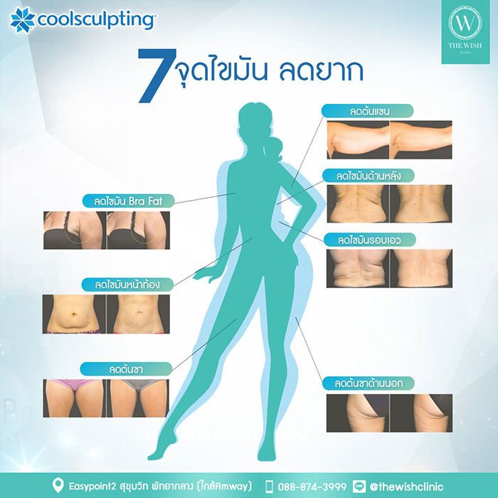 Coolsculpting33