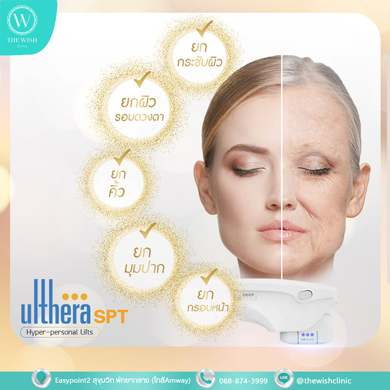 ULTHERAPY