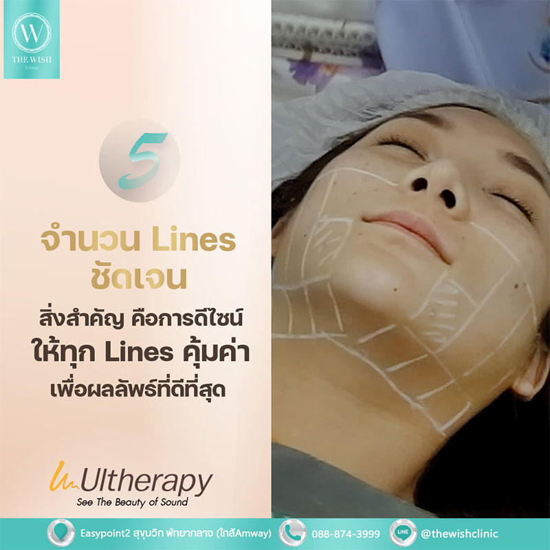 ULTHERAPY5