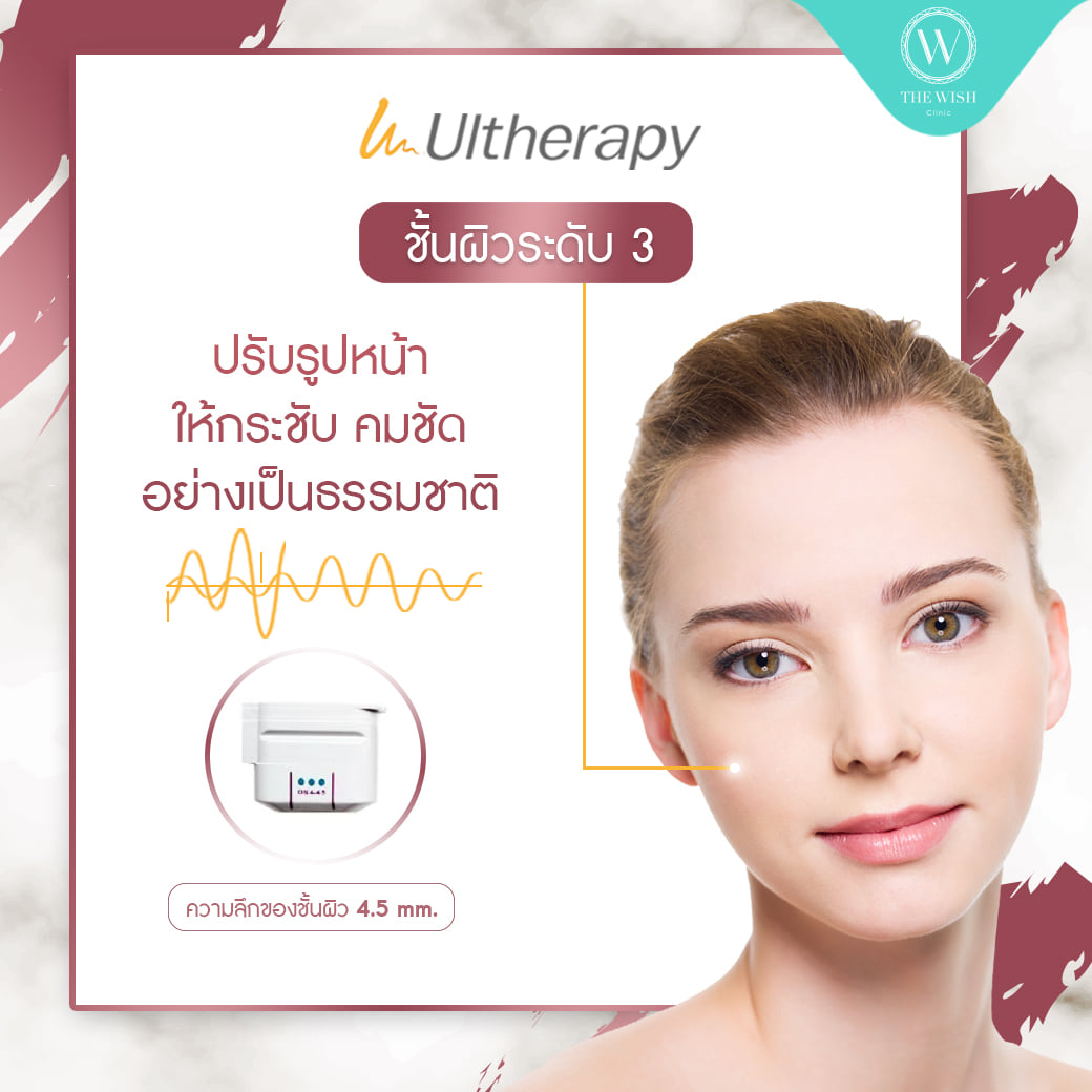 Ultherapy3