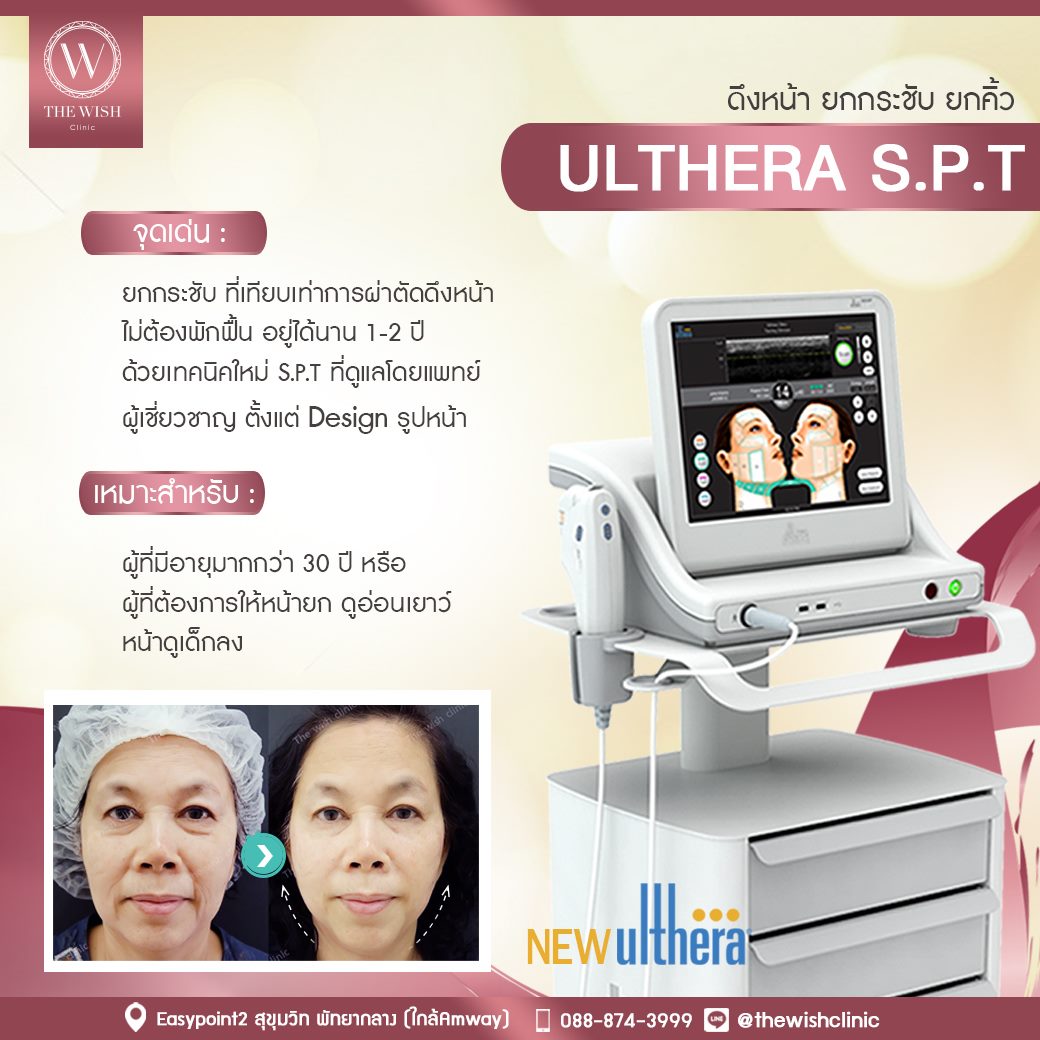 Ulthera-SPT-1