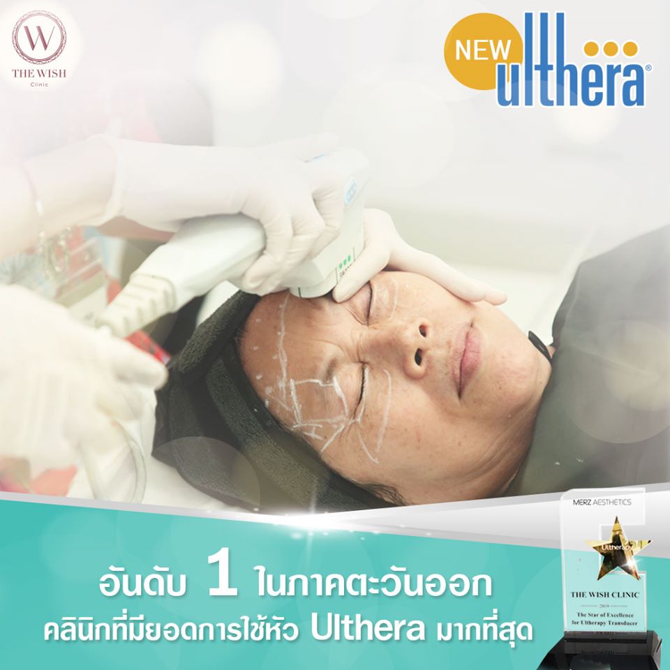 New Ulthera2