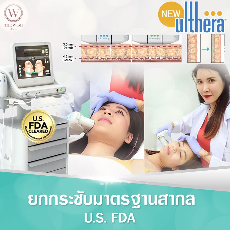 New Ulthera3