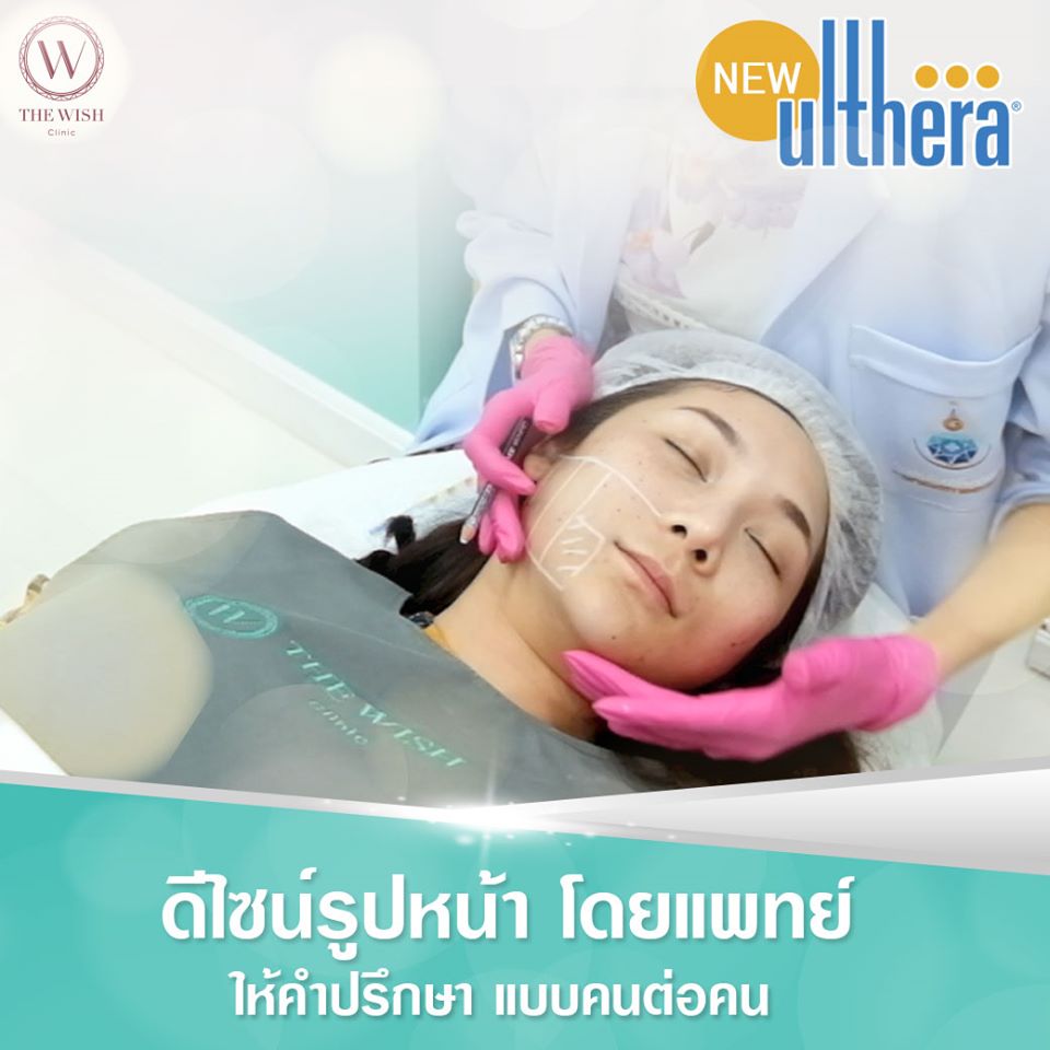 New Ulthera4