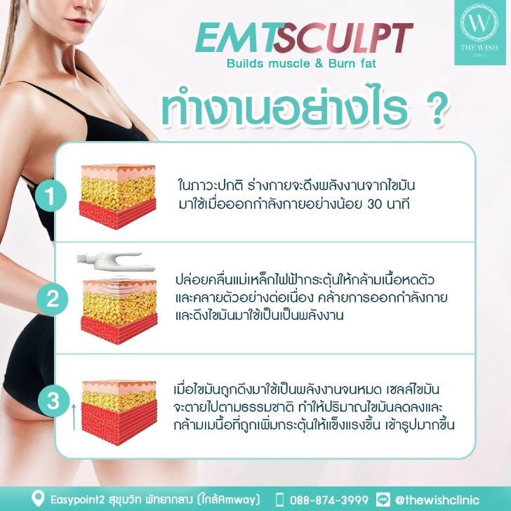 New Coolsculpting3