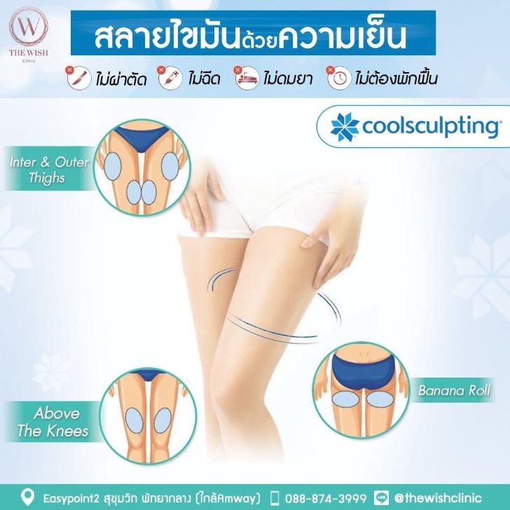 New Coolsculpting3