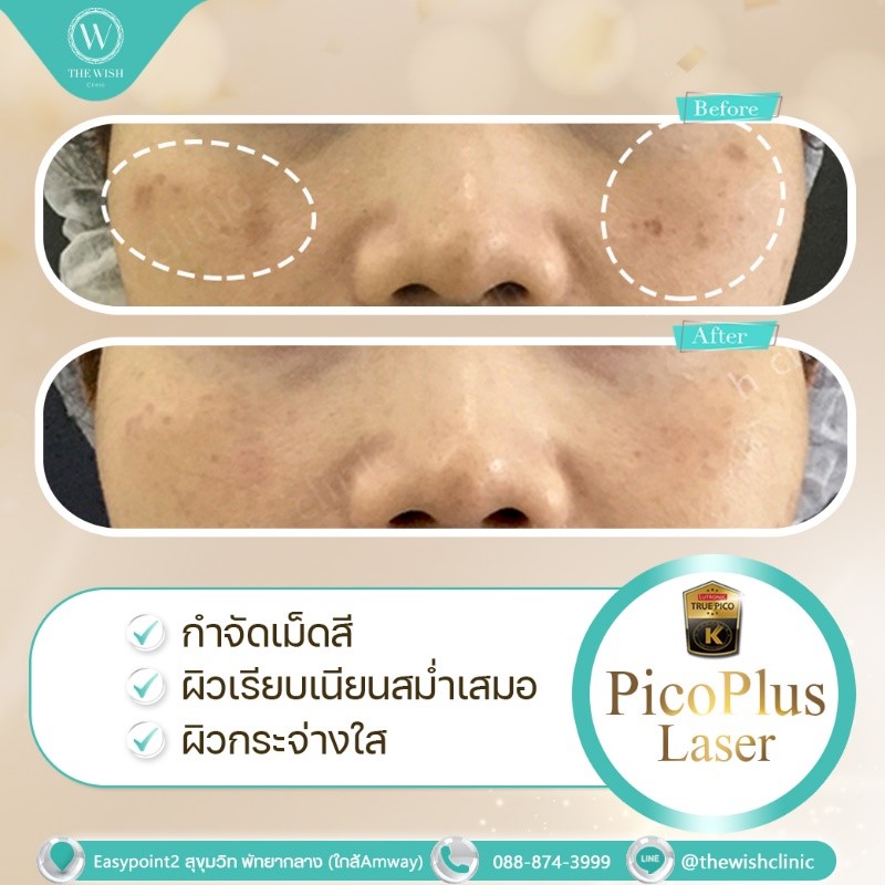 Picoplus