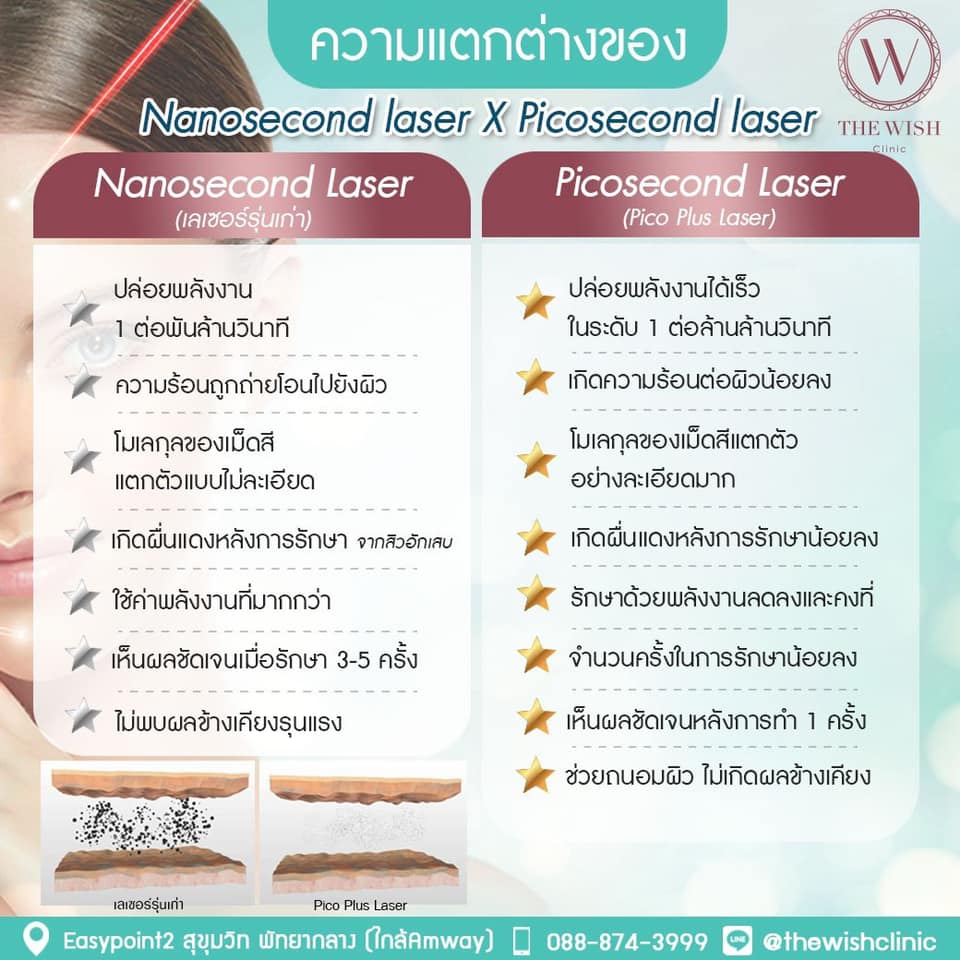 advantage Ulthera