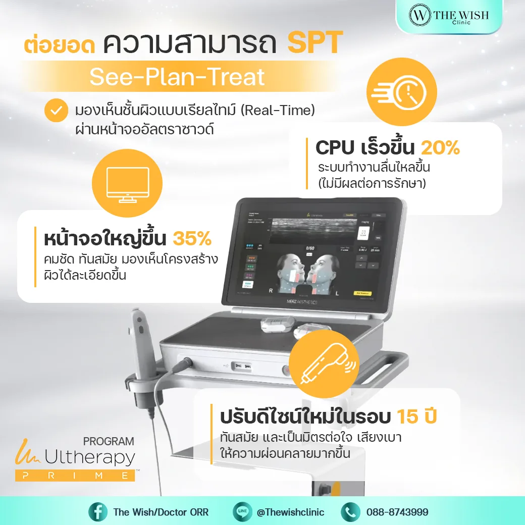 ultherapy prime